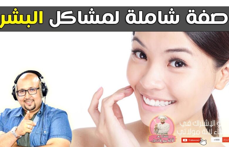 وصفة الدكتور عماد ميزاب لتخلص من البقع السوداء